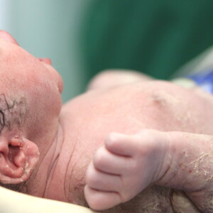 The Apgar score